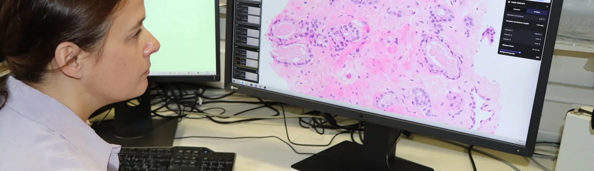 Researcher Clare Verrill Using AI Software For Pathology
