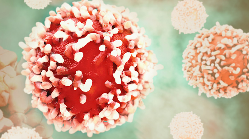 Cancer Cell Research Science Adobestock 96172433
