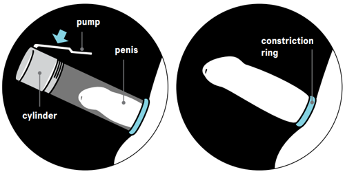 A graphic showing how a vacuum pump works.
