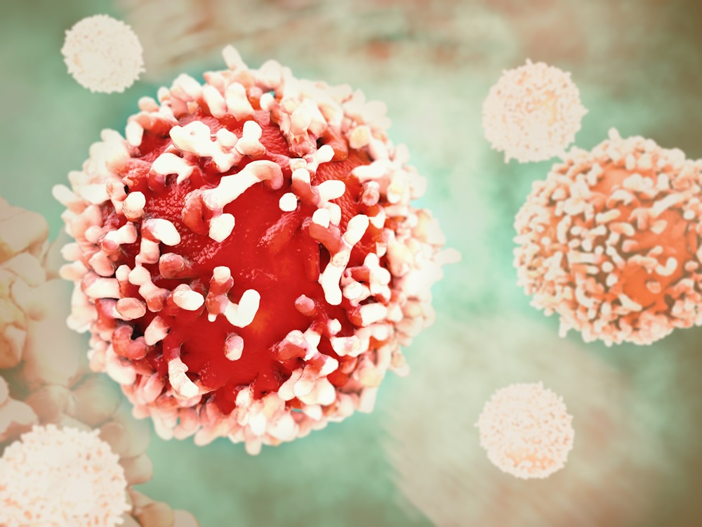 Adobestock 96172433 Cancer Cell In Human Body