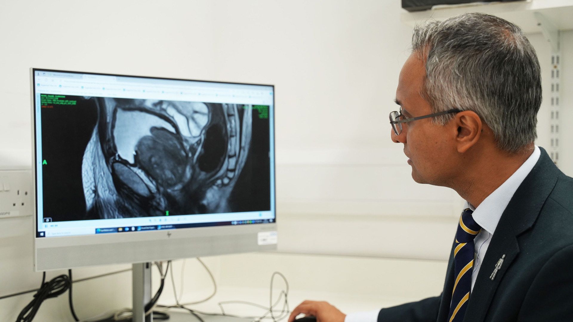Hashim Computer A better future for men: why routine screening is still within reach ...