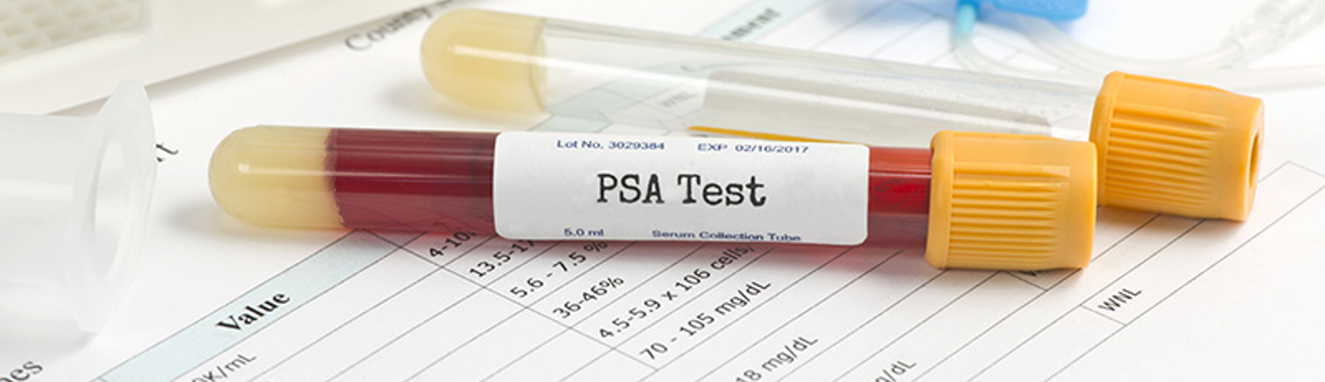 PSA Test Adobestock 103064808