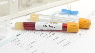 PSA Test Adobestock 103064808