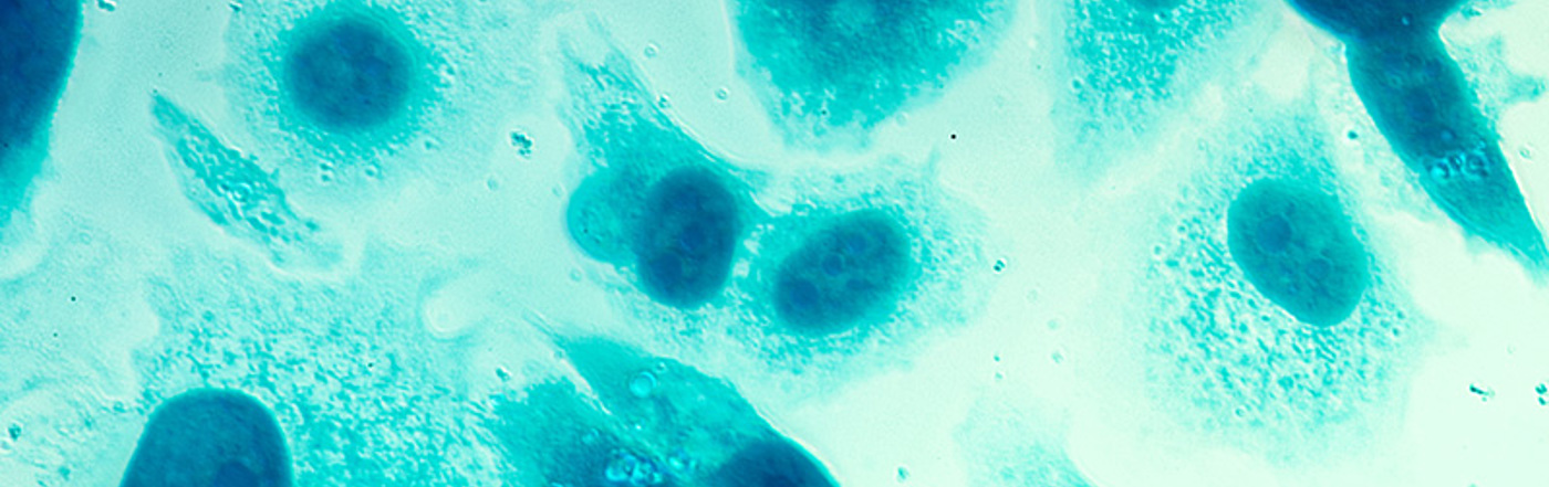 Prostate Cancer Cell Research Adobestock 111509561 PC 3