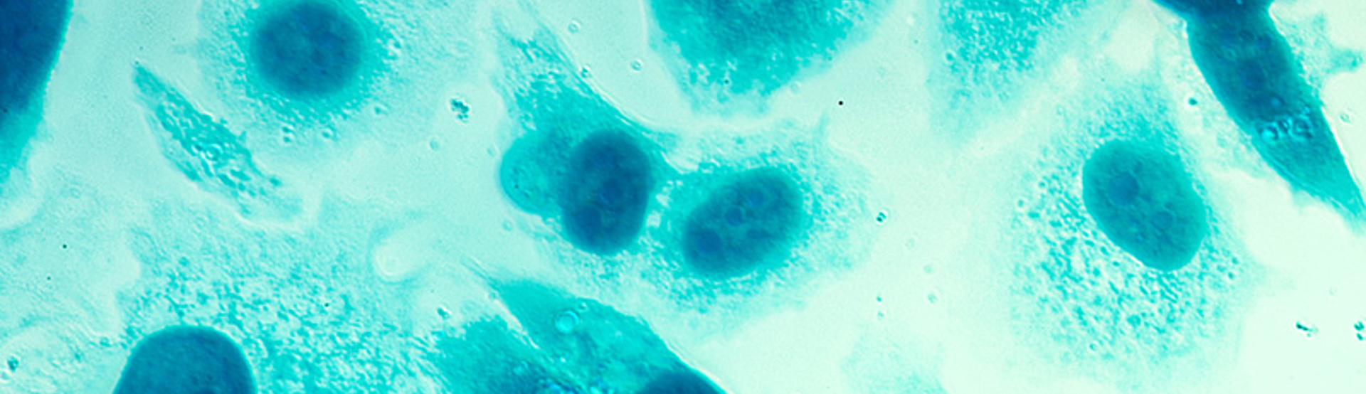 Prostate Cancer Cell Research Adobestock 111509561 PC 3