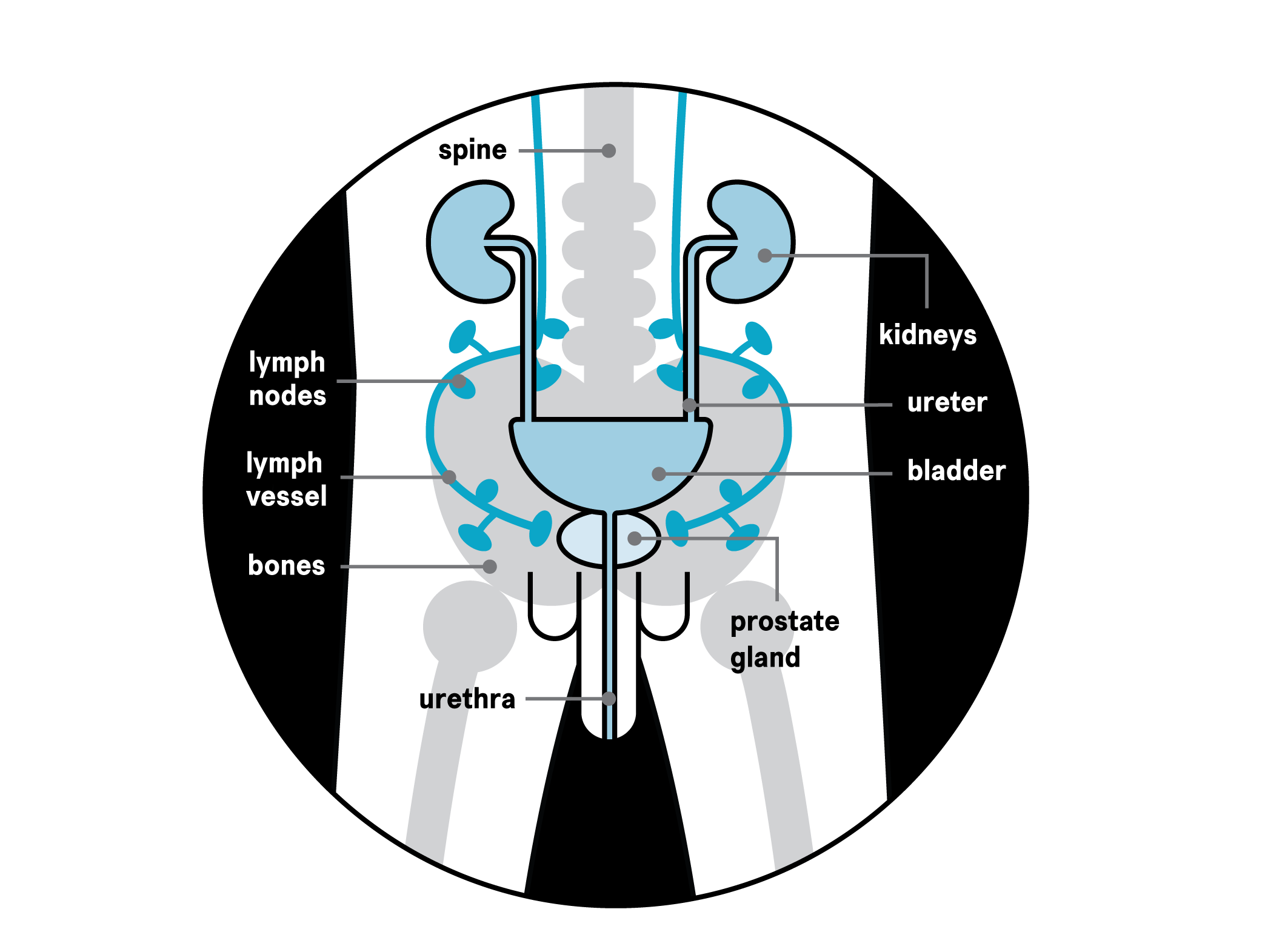 Diagram showing the spine, kidneys, ureter, bladder, prostate gland, urethra, bones, lymph vessel and lymph nodesr
