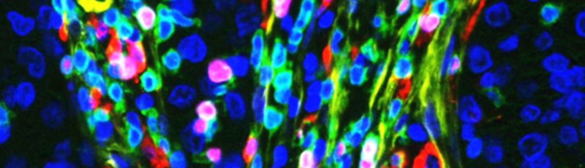 Claire Lewis Sheffield Nanoparticles Image