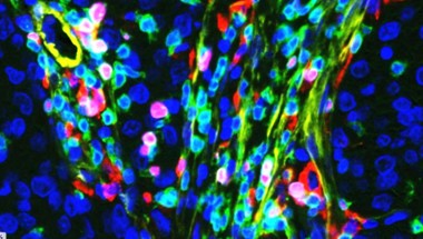 Claire Lewis Sheffield Nanoparticles Image