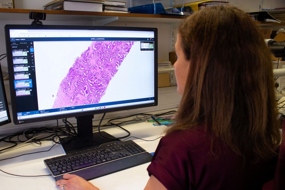 Professor Clare Verrill Prostate Cancer UK Researcher At Computer