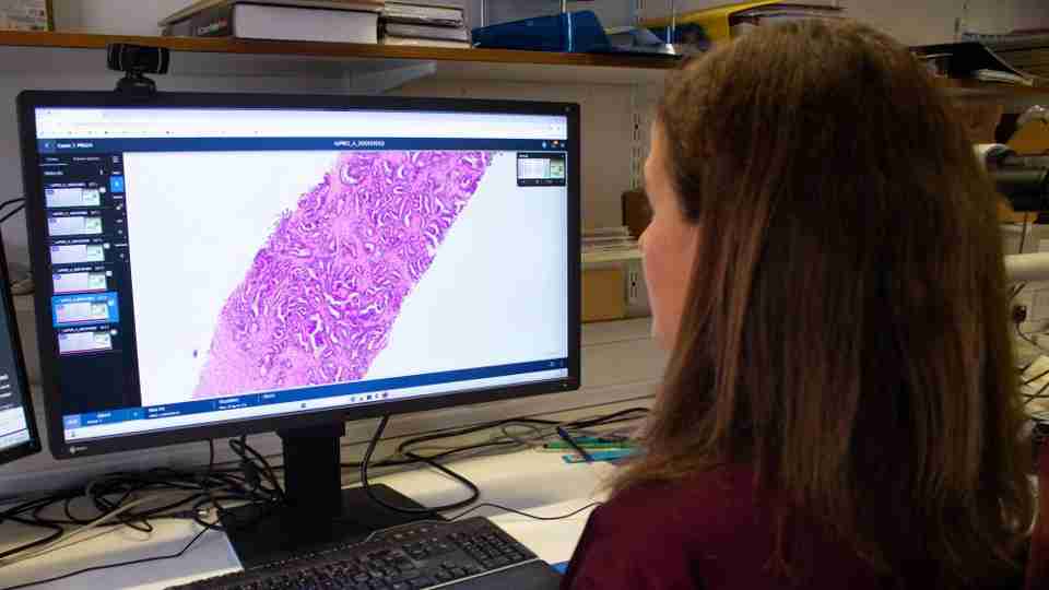 Var Rill Can this cutting-edge AI tool change the way we diagnose and treat ...