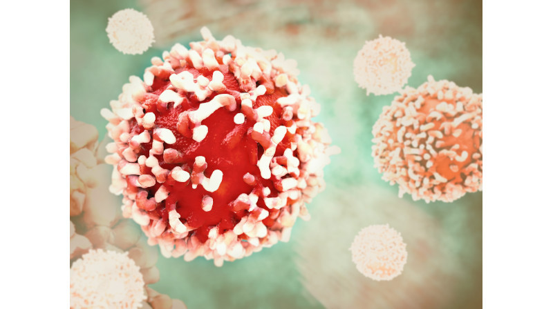 Cancer Cell In Human Body